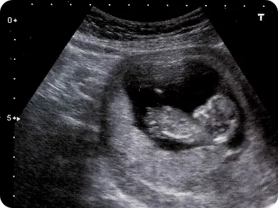 ultrasound (1)